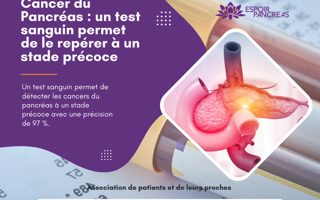 Cancer du pancréas : un test sanguin permet de le repérer à un stade précoce 