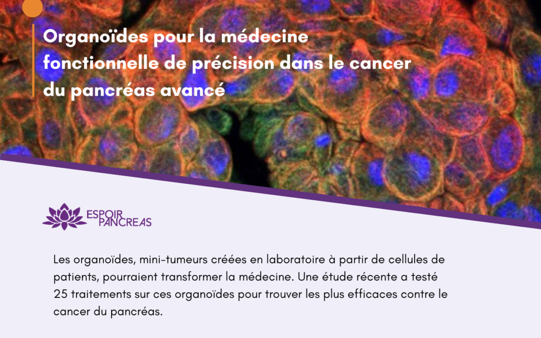 Les organoïdes révolutionnent la médecine de précision pour le cancer du pancréas !
